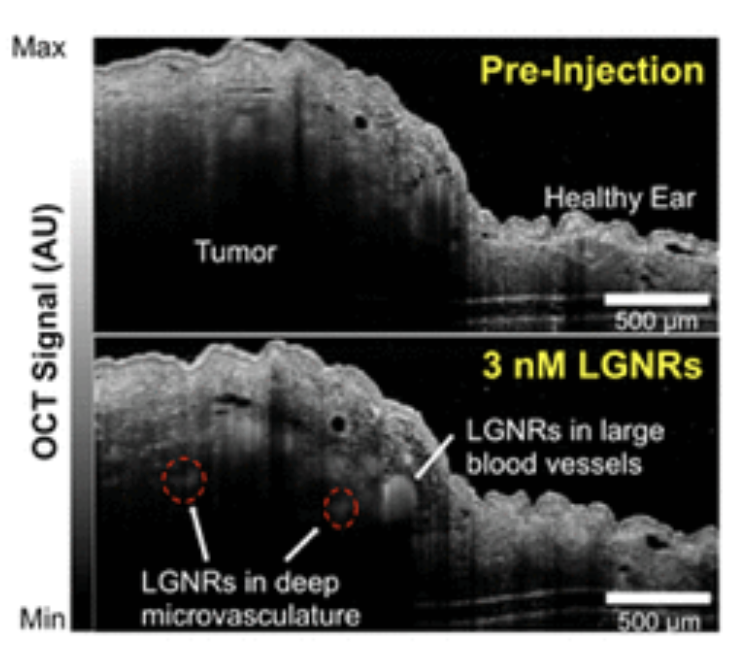 lgnr-bio.png